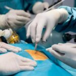 hernia treatment in india