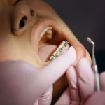 67a5ff1192ffe24456752691_When Should My Child See an Orthodontist_ (1)