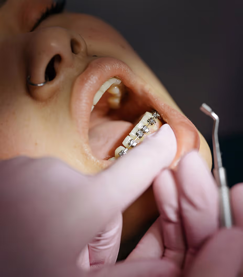 67a5ff1192ffe24456752691_When Should My Child See an Orthodontist_ (1)