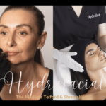 Hydrafacial Treatment