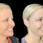 Best Aesthetic Clinic in Dubai