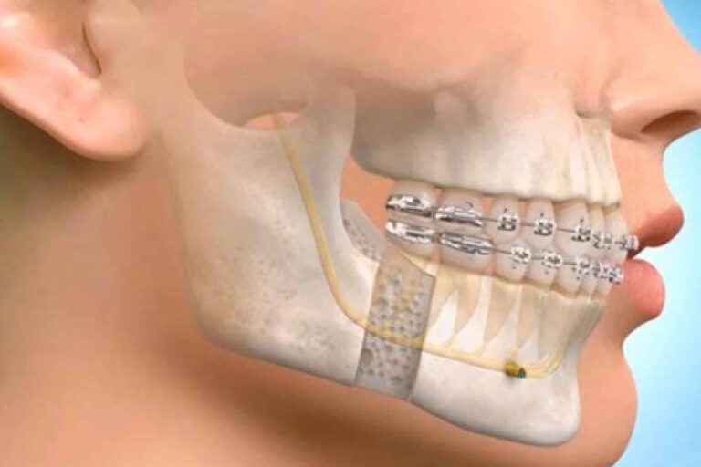 Oral-Maxillofacial-Surgery-01-1 (1)