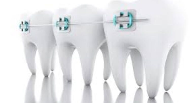 Social Media Content Ideas for Orthodontists image