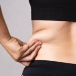 vaser liposuction in dubai