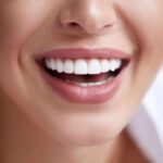 teeth_whitening_zoom-scaled
