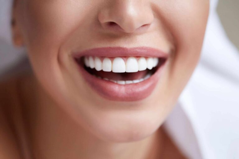 teeth_whitening_zoom-scaled