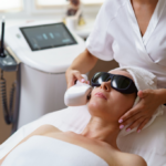 Melasma in Manchester