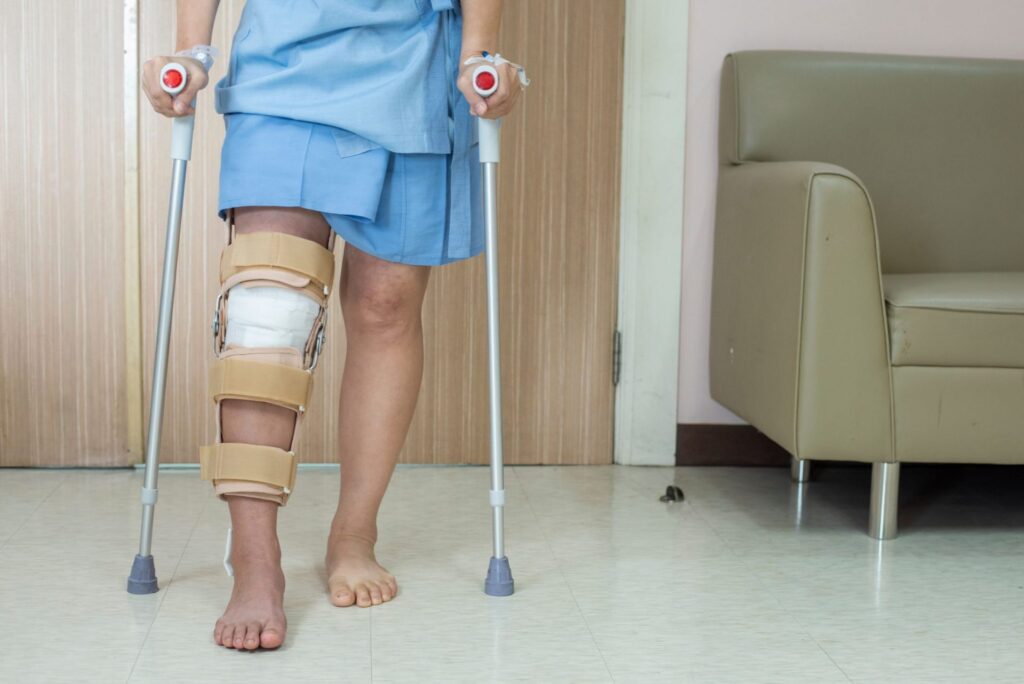 ACL-Injury-Treatment