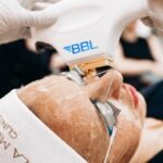 Bbl Laser In Manchester