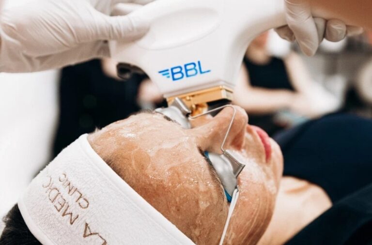 Bbl Laser In Manchester