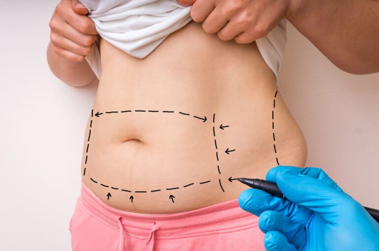 How to Prepare for Your Mommy Makeover in Dubai