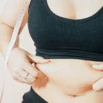 Liposuction ion Dubai