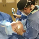 Gynecomastia surgery in Lahore