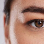 Upper blepharoplasty dubai