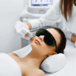 Laser hair removal Edmonton