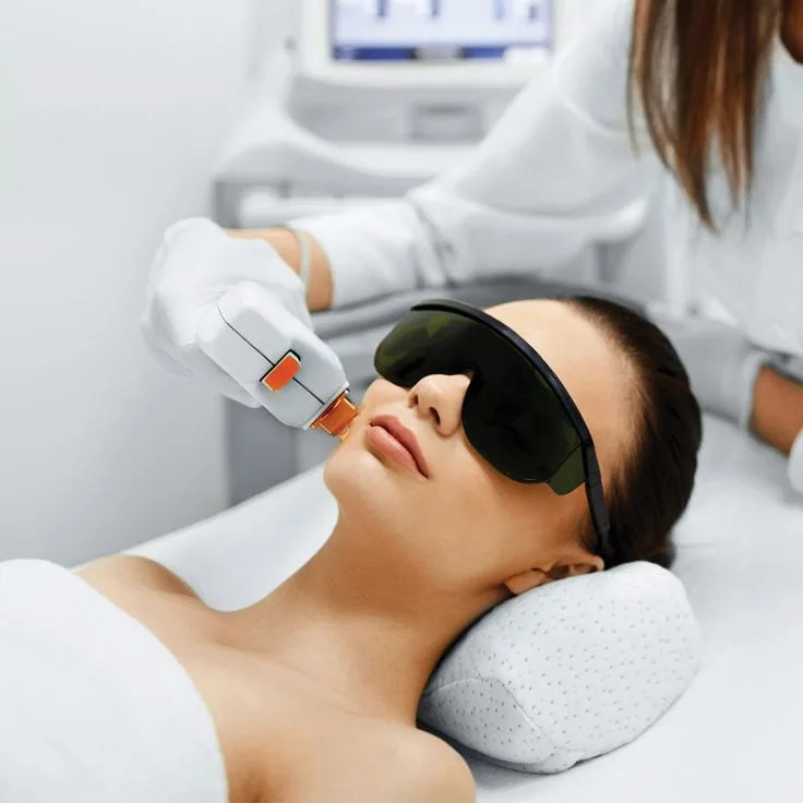 Laser hair removal Edmonton