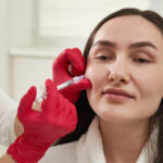 Dermal-Fillers-in-Dubai-Before-and-After-Face