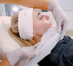 Skinvive Treatment In Manchester
