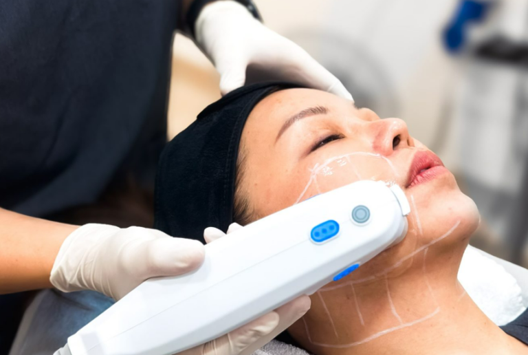 ultherapy treatment