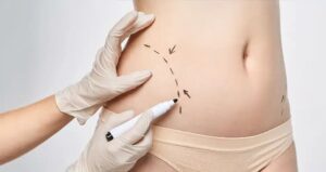 Body Contouring in Dubai: What to Expect During Treatment