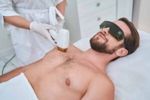 laser hair removal Edmonton